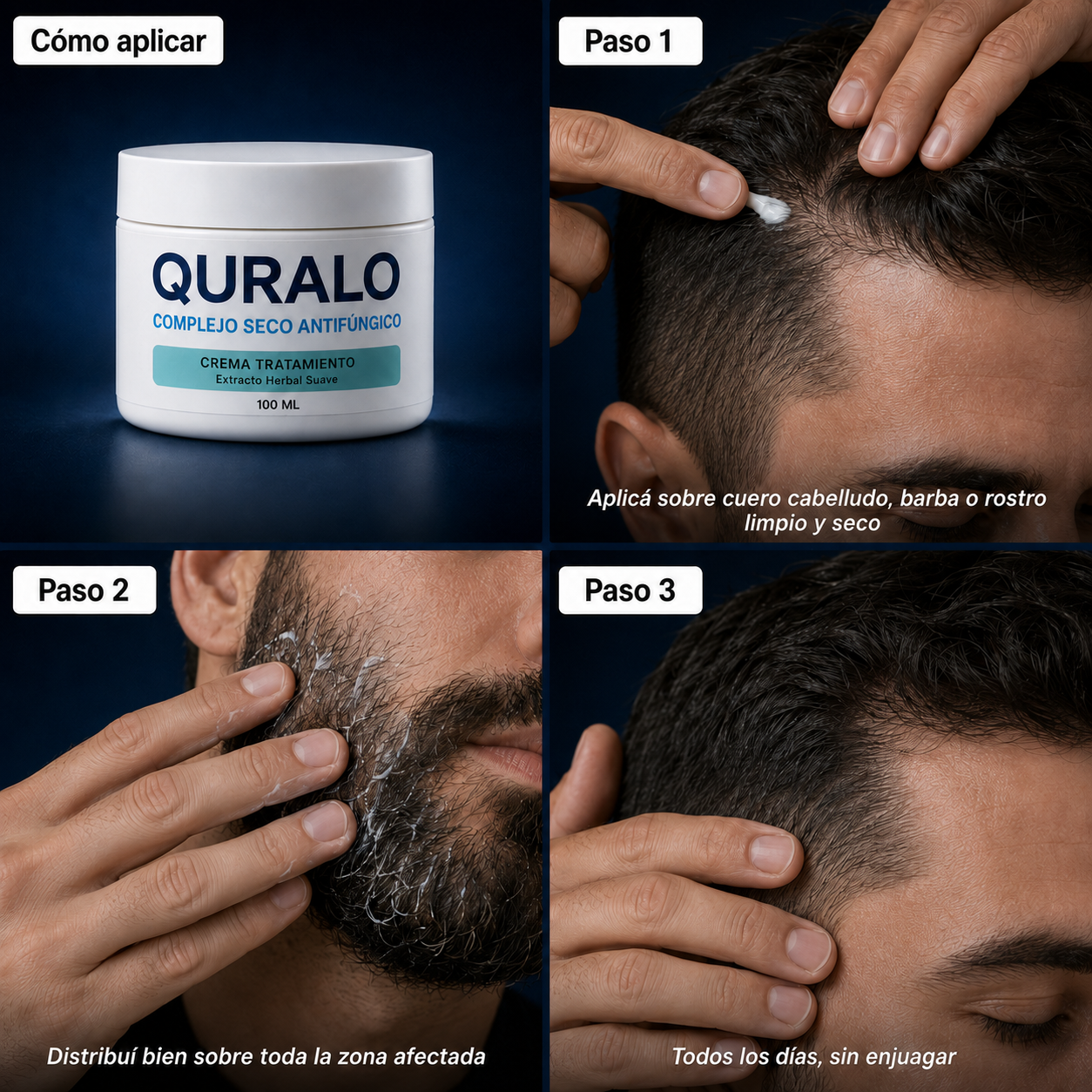 QURALO| Crema contra la caspa y dermatitis seborreica